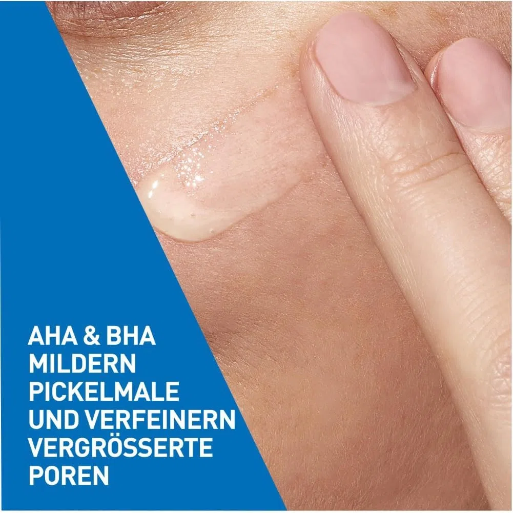 CeraVe Hautbilderneuerndes Retinol Serum, Zuverlässige Pflege bei unreiner und zu Akne neigender Haut, Aufhellender Effekt durch Süßholzwurzelextrakt, Mit 3 essenziellen Ceramiden, 30 ml