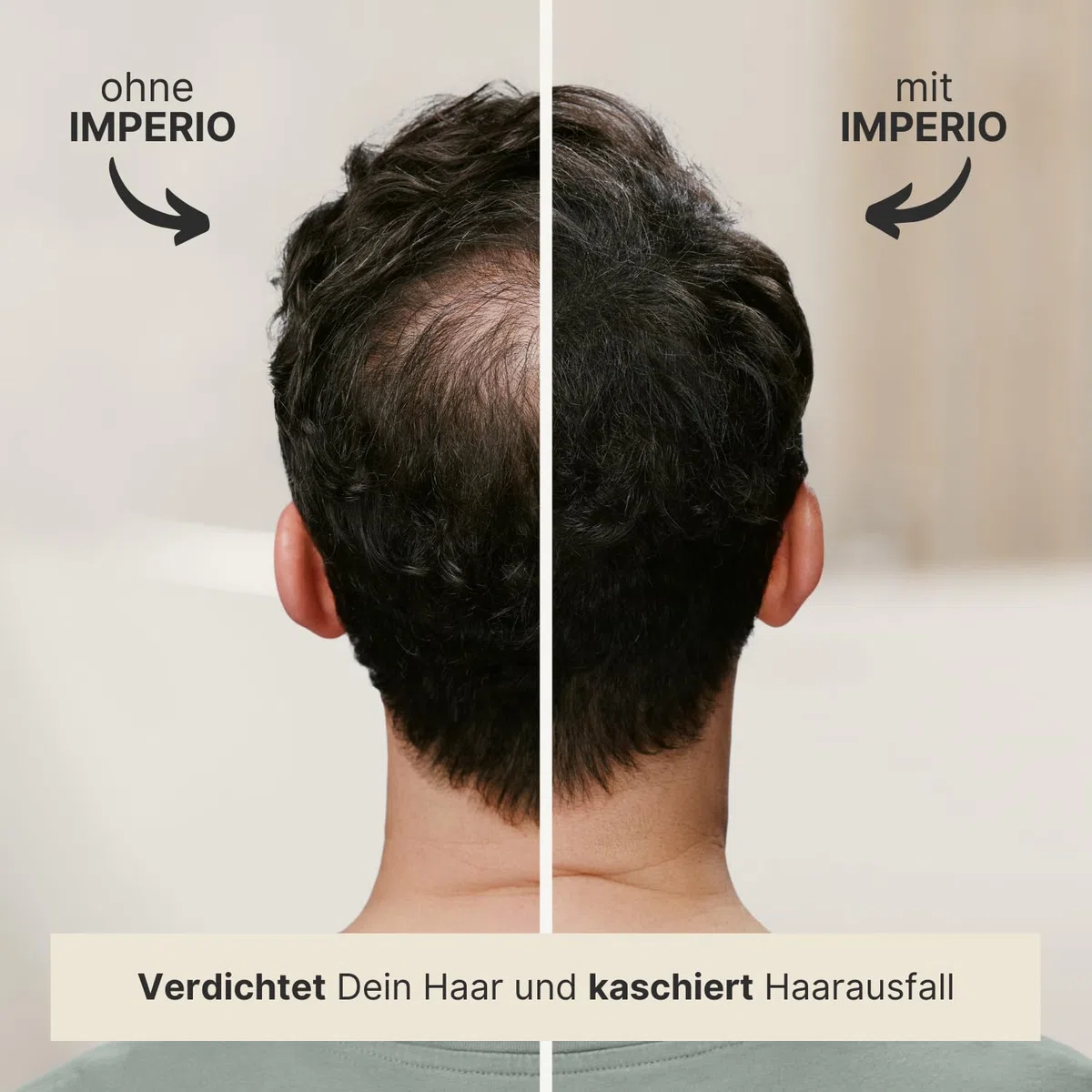 IMPERIO Streuhaar zur Haarverdichtung & vollem Haar in Sekunden. Schütthaar für einen authentischen Look. 100% Natur! In Premium Friseurqualität - 26g (Dunkelbraun)