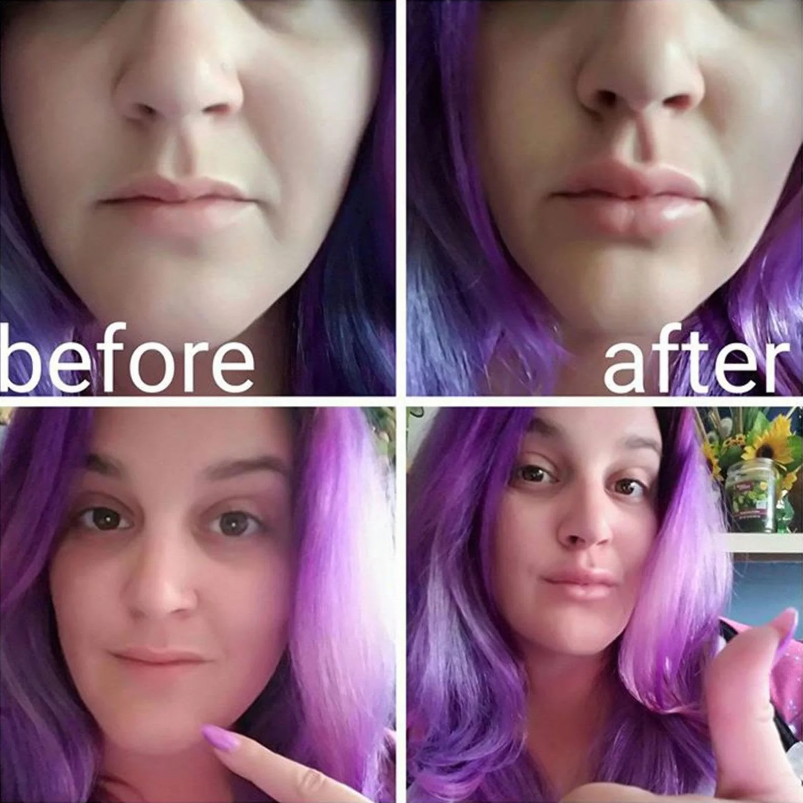 Lip Plumper Fischform-Lippenverstärker, Lippen Sauger Booster, Tragbares Handgroßes Silikoninstrument Mit Lippenpraller Lippenfüller, Lippen-Mund-Schönheit Für Den Täglichen Gebrauch Mit Sexy Lippen