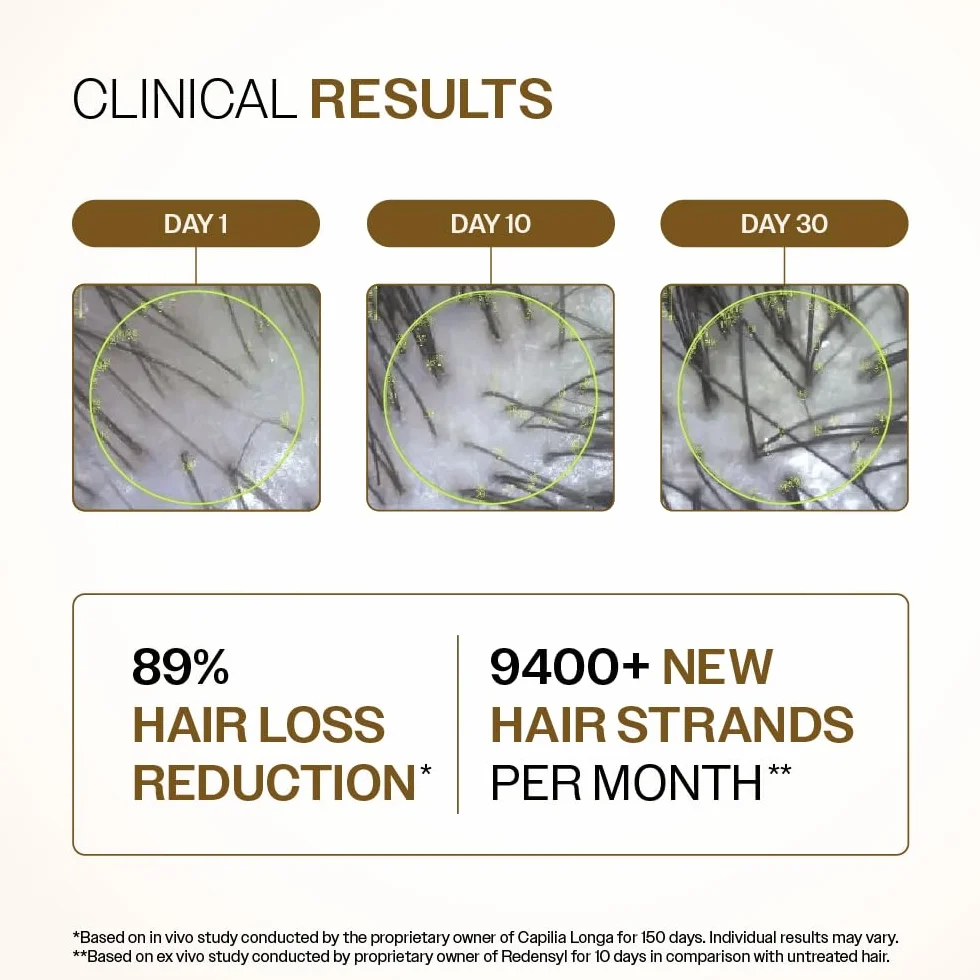 Bare Anatomy Advanced Hair Growth Serum | 3% Redensyl + 4% Anagain + 3% Baicapil + 1% Capilia Longa, Rosemary, Biotin & Rice Extract | Hair growth & Hair fall control serum for Women & Men | 30mL