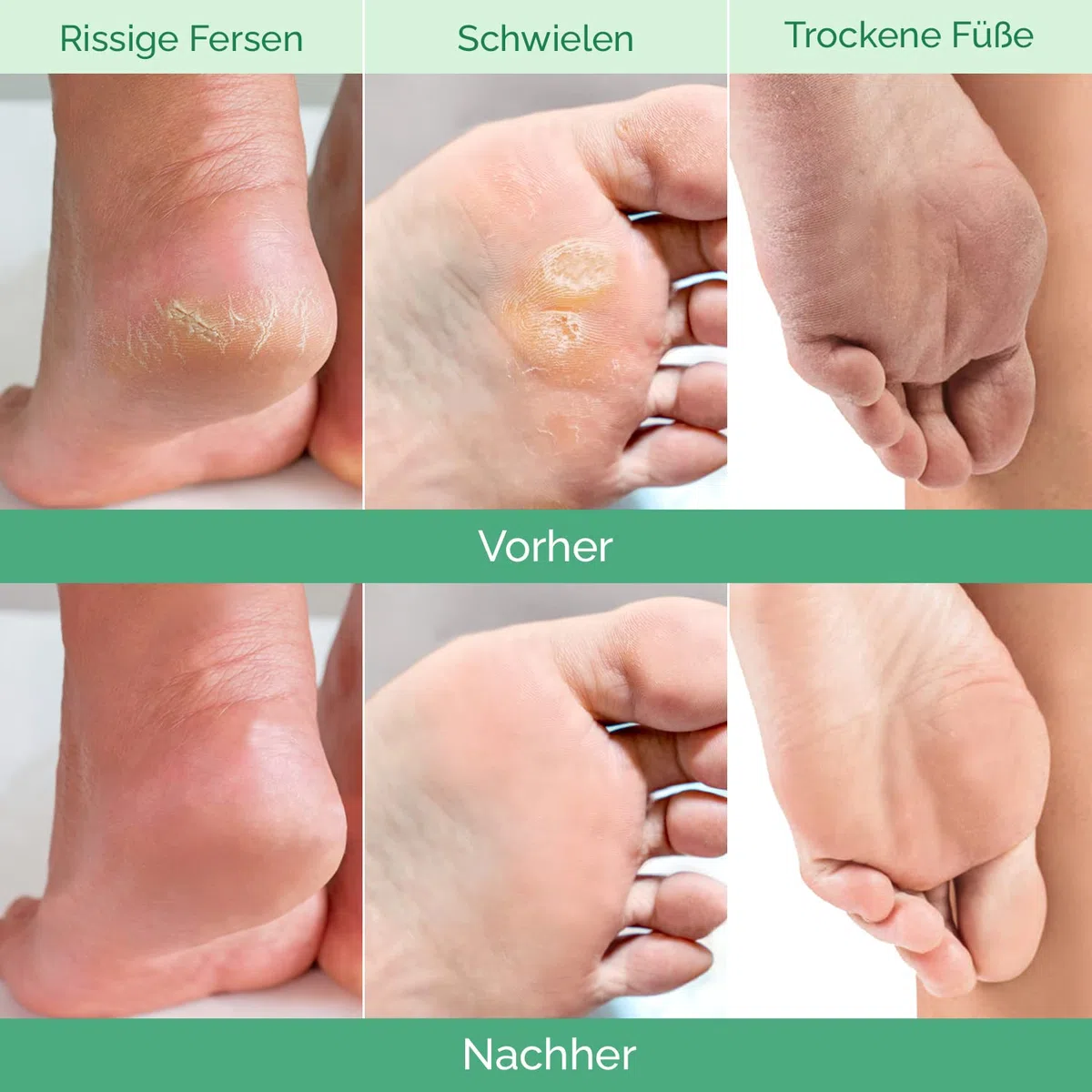 Plantifique Fußmaske - Hornhaut Socken - 2 Paar Pfirsich Fussmaske Hornhautentferner Socken - Hornhaut entfernen fuß - Foot Peel Mask Fußpeeling - Fußpflege Geschenke