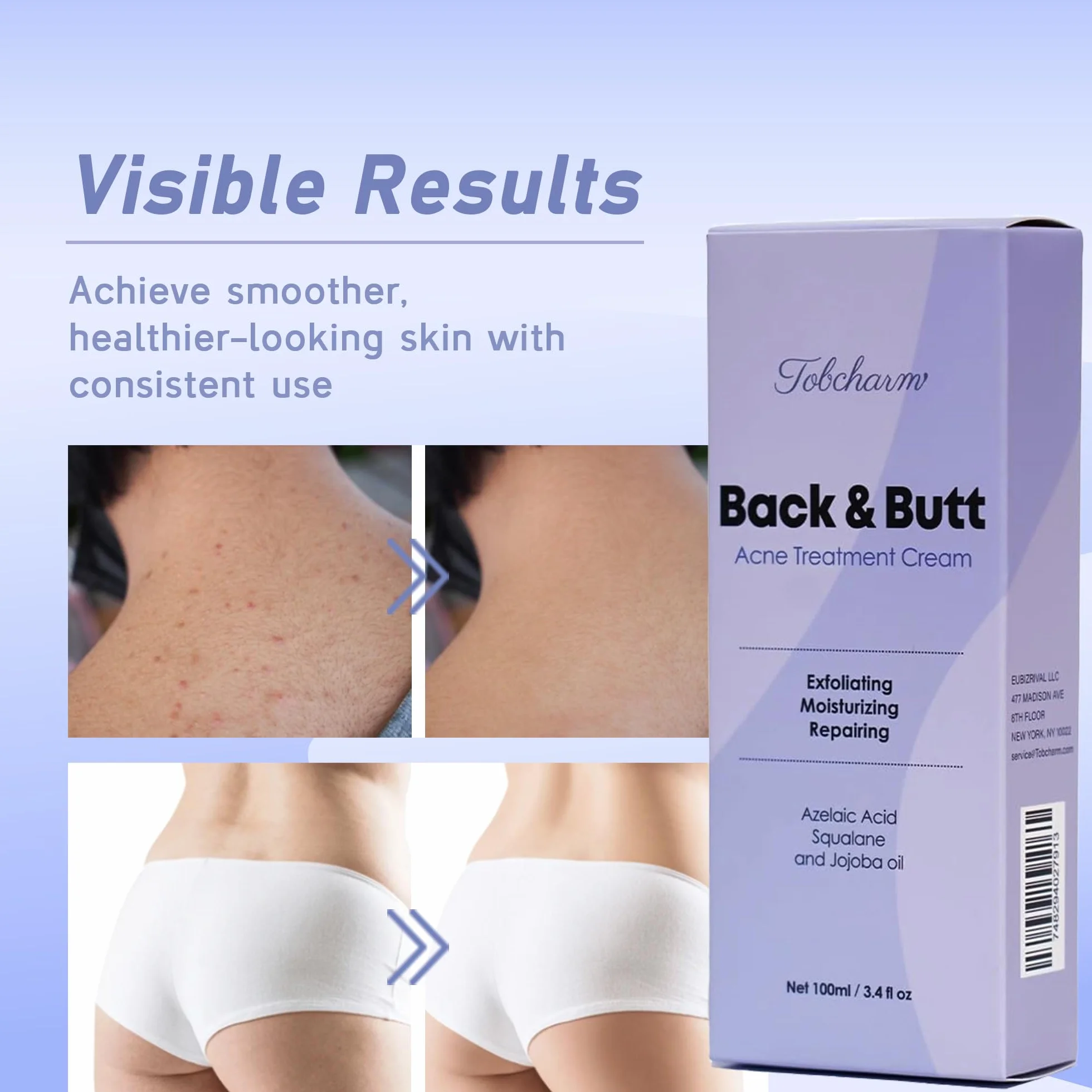 Tobcharm Butt Akne Clearing Behandlung, maximale Stärke Körpercreme für Rücken, Gesäß, Oberschenkel & Brust Akne Entfernung, Hautklärende Lotion für Männer & Frauen, Schaumreiniger für Bacne