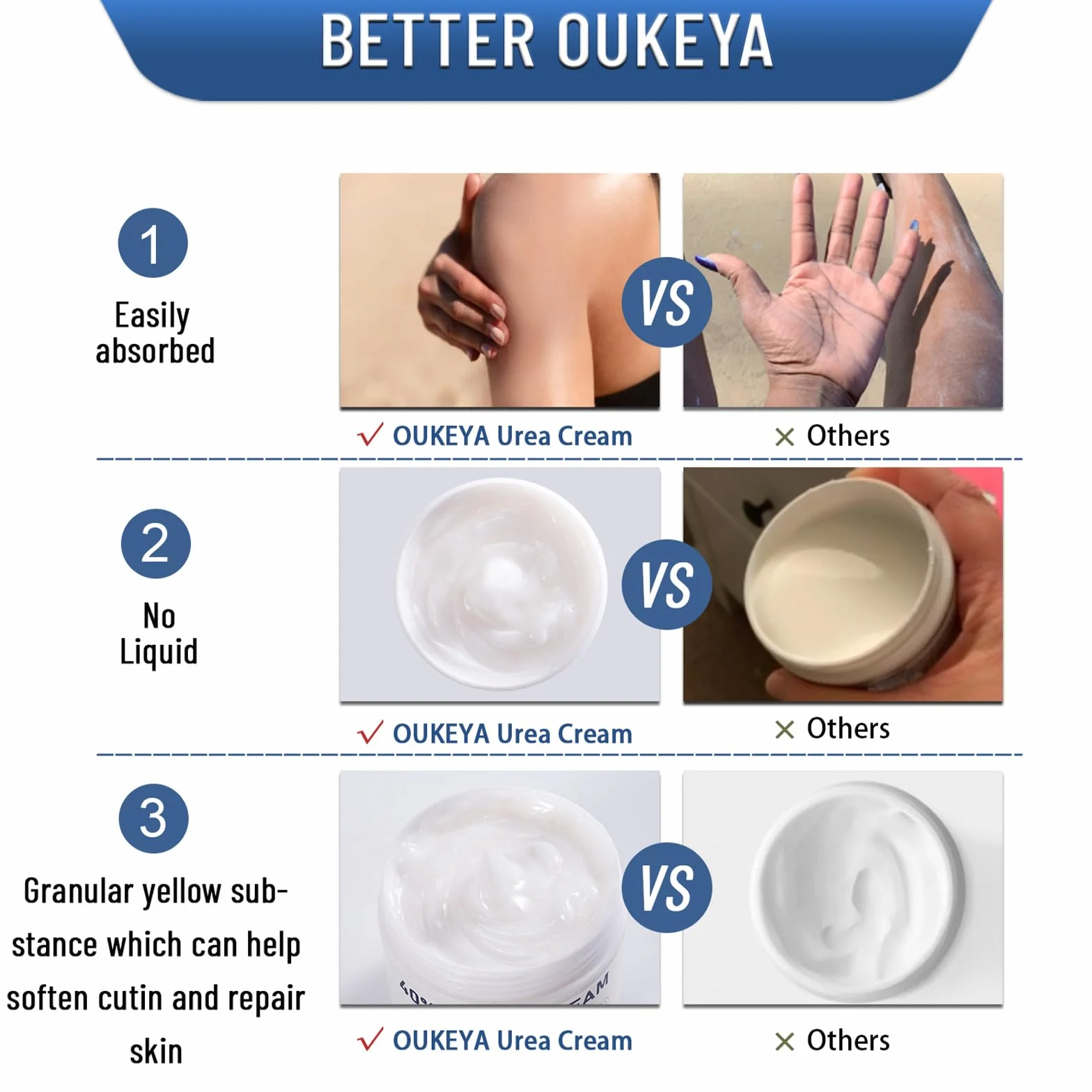 OUKEYA Urea-Creme 40 Prozent für Fuß und Hände, Urea Cream, Urea-Fuß, Fußcreme, Harnstoffcreme für Trockene, Rissige Füße, Anti Hornhaut, 40 Pro Urea-Lotion für Fersen, Ellenbogen, Maximaler Stärke
