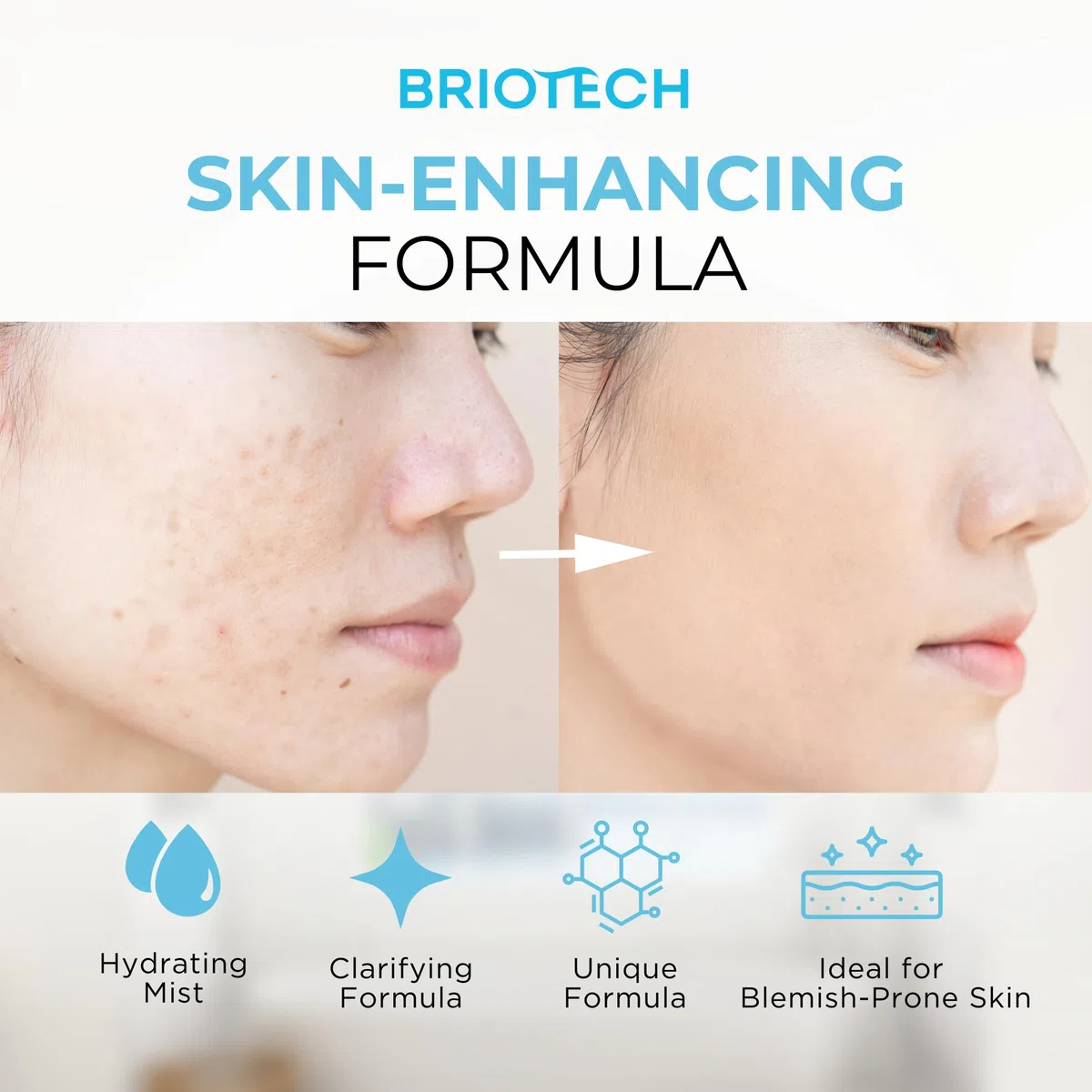 BRIOTECH Skin Renew Toner Gesichtsspray - reines Hypochlorous Acid Spray - beruhigendes HOCl Gesichtswasser für alle Hauttypen - feuchtigkeitsspendender, Erfrischung Hypochlorige Säure Toner, 100 ml