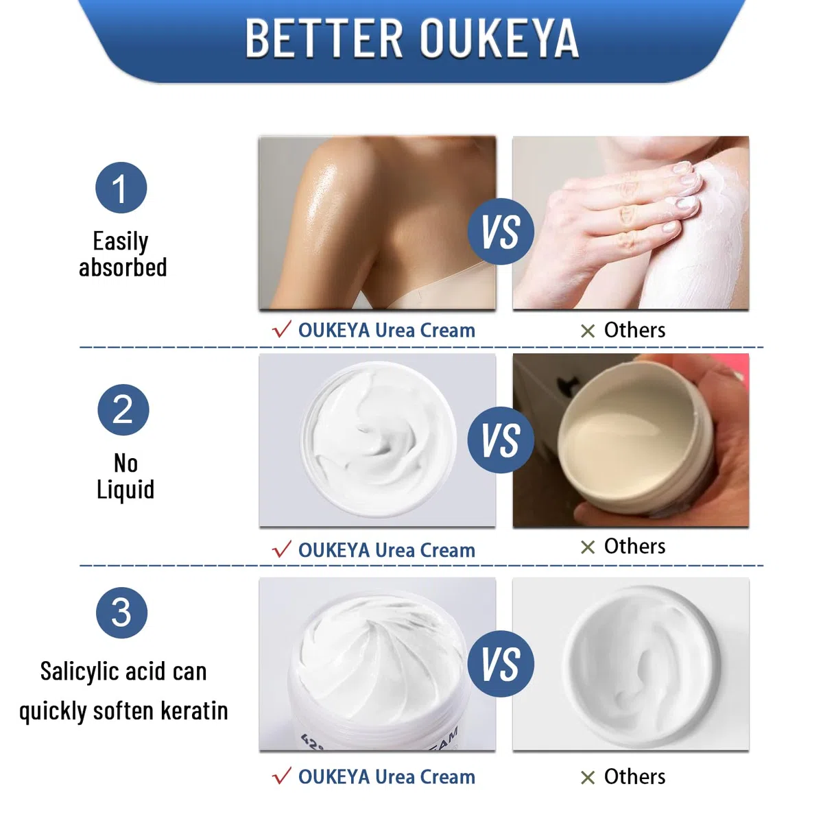 OUKEYA Urea Creme 42% mit 2% Salicylsäure, Fusscreme Feuchtigkeit & Reparatur für Trockene, Füße, Fersen, Knie, Urea Handcreme für Hände, Fußcreme, Hornhautentferner, Entfernt Hühneraugen, Tote Haut