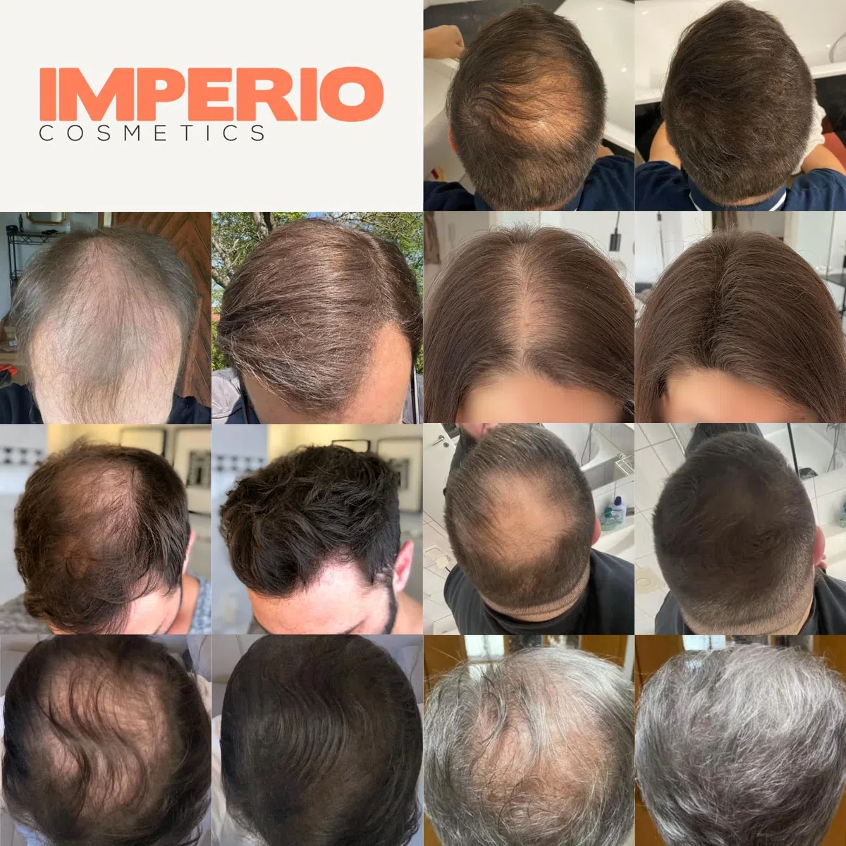 IMPERIO Streuhaar zur Haarverdichtung & vollem Haar in Sekunden. Schütthaar für einen authentischen Look. 100% Natur! In Premium Friseurqualität - 26g (Dunkelbraun)