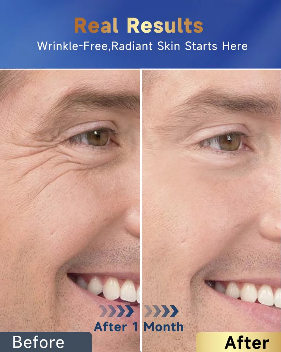 Retinol-Creme für das Gesicht, feuchtigkeitsspendende Gesichtscreme mit Kollagen und Hyaluronsäure, Anti-Aging-Halscreme zur Straffung der Haut, Gesichtspflege für Tag und Nacht, für Frauen und Männer