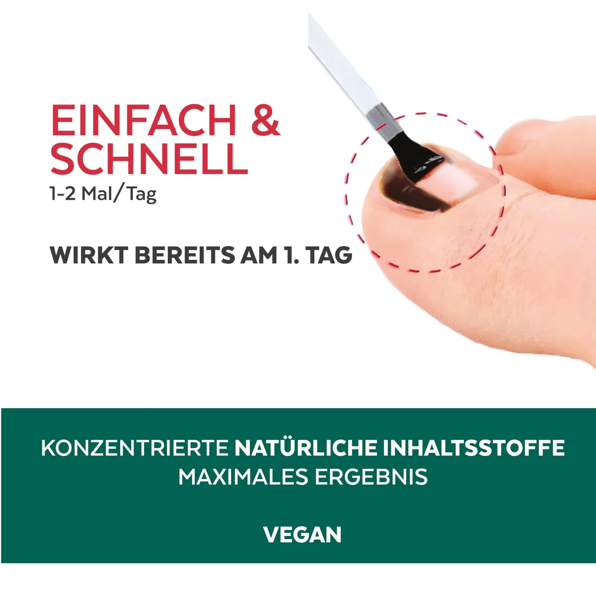 PODERM - BLAUE TRAUMATISIERTE NÄGEL | Pflanzliche Behandlung gegen Hämatome, Pilze und Bakterien | Repariert und pflegt | Professionelle Fuß- und Handpflege | Einfach & schnell | Swiss Made