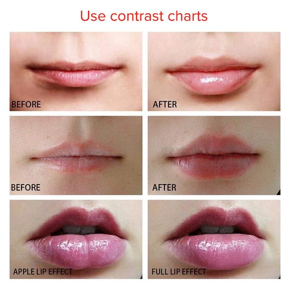 Automatik Lip Plumper Enhancer Gerät Elektrisch Vollere Lippe Silikon Dickere Lippen - Plumping-Tool Gesichts-Beauty-Tool Verbesserung Der Lippe USB-Aufladung Tragbare Größe
